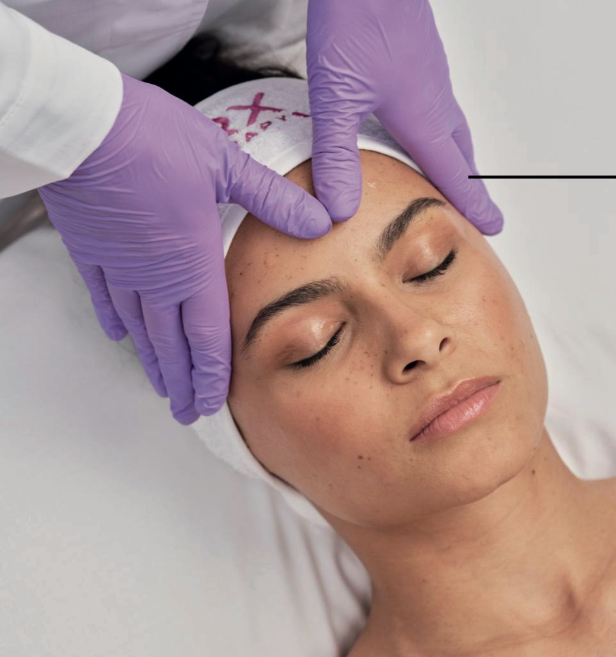 Exosome Therapy Sunshine Coast